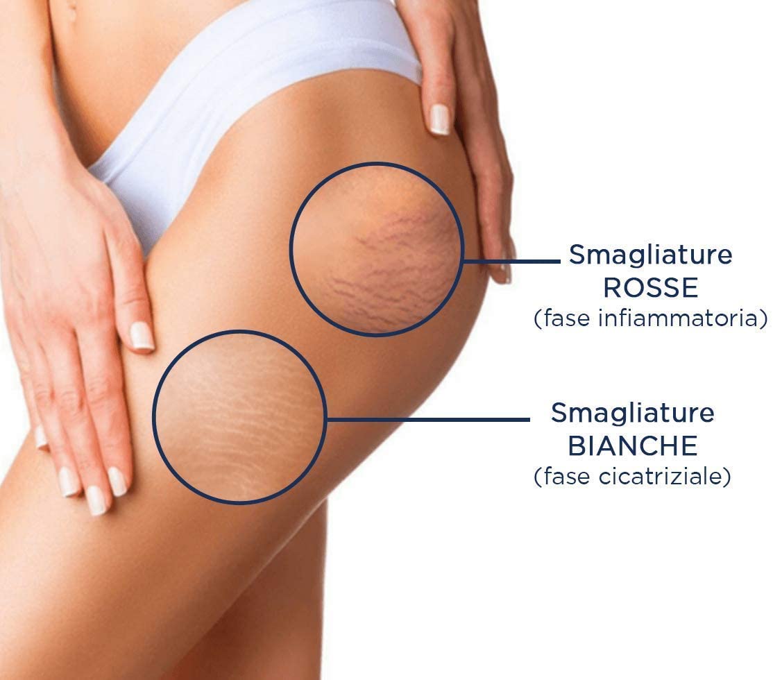 SMAGLIATURE